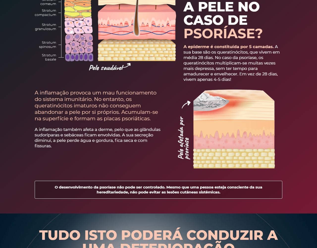 Psoriaderm 2