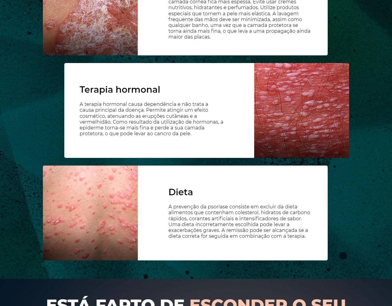 Psoriaderm 4