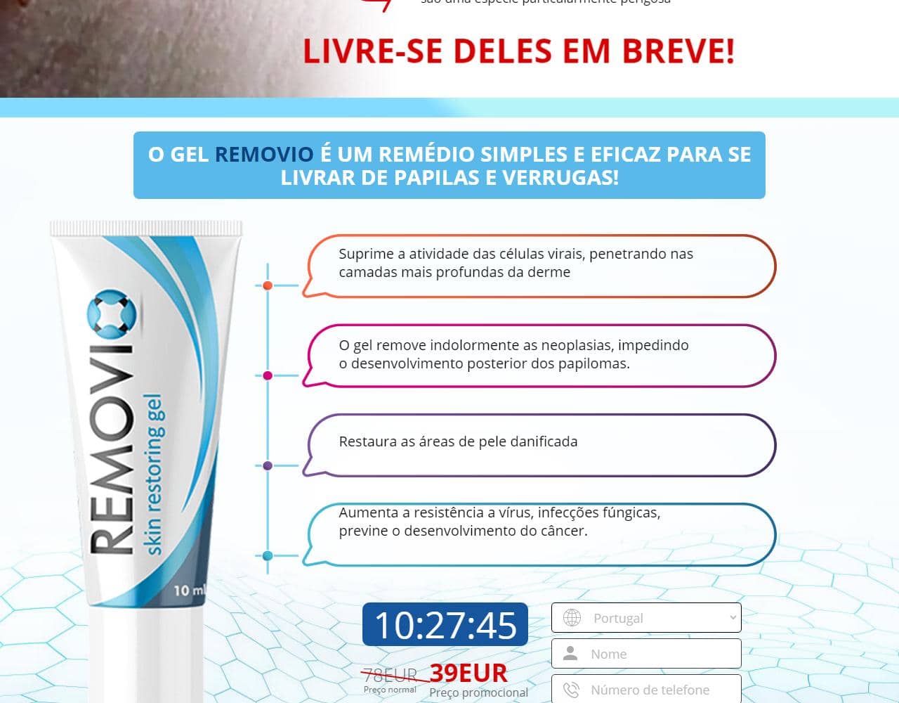 Removio 4