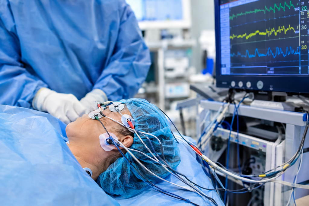 Intraoperative Neuromonitoring: Electrode Requirements in the OR